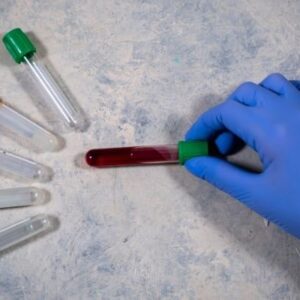 臨床検査技師が治験業界に転職するには？CRCの年収・求人事情と成功のポイントを解説