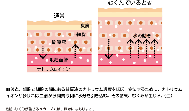 むくみが出てしまう仕組み